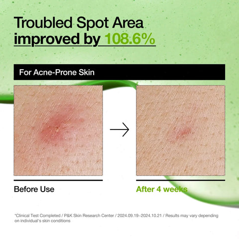 Azelaic Acid 10 Hyaluron Redness Soothing Serum